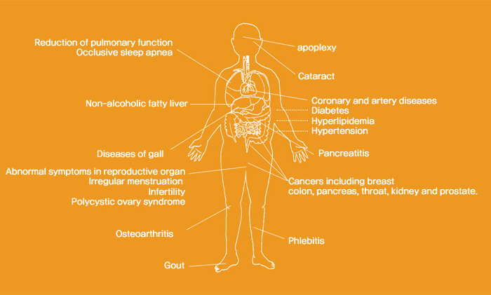비만에 따른 인체부위의 병